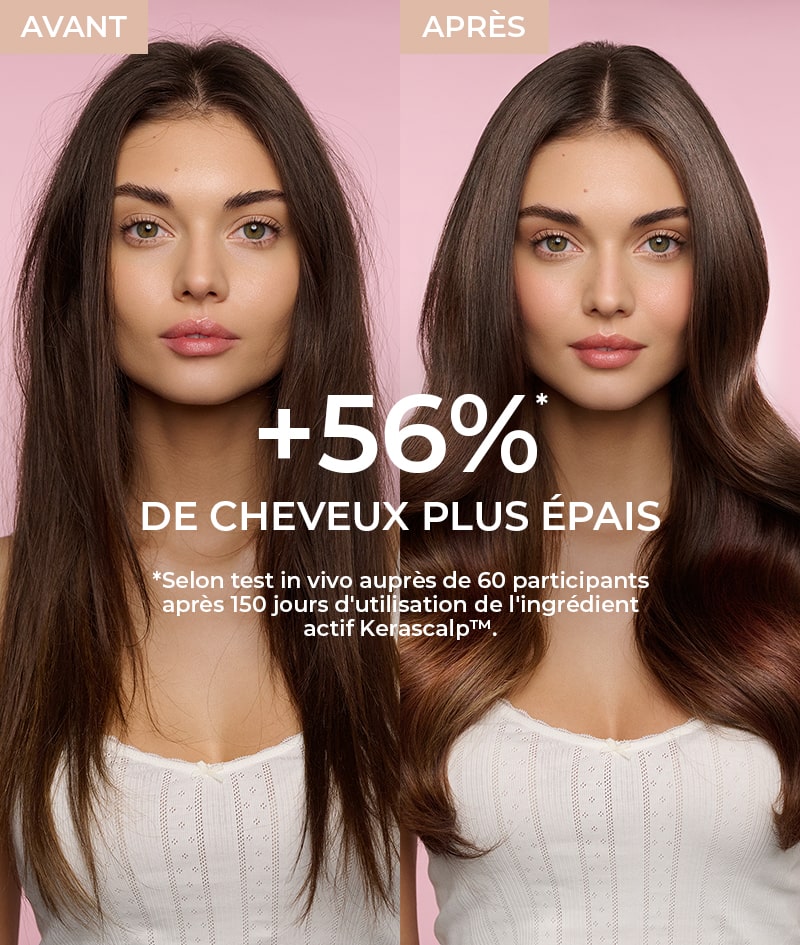 HAIR GOALS: Créez les conditions parfaites pour la croissance capillaire avec le shampooing et l'après-shampooing GROW au KERASCALP™. Ils agissent à partir des racines, aux résultats cliniquement prouvés pour rendre les cheveux plus denses, plus épais et plus brillants.