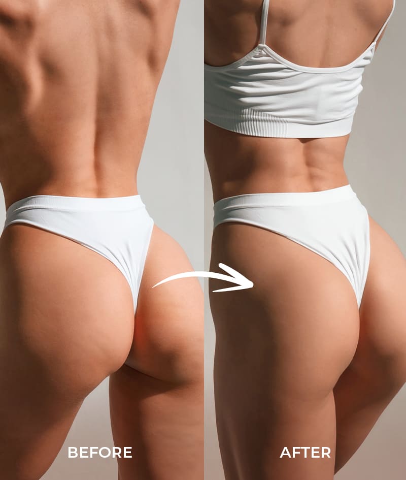 ANTI-CELLULITE POWER: Le sérum SKIN+ réduit visiblement la cellulite grâce à 4 principes actifs en concentration maximale. L'huile sèche SKIN Anti-cellulite renforce l'effet anti-cellulite grâce à un actif naturel et à des huiles bio.