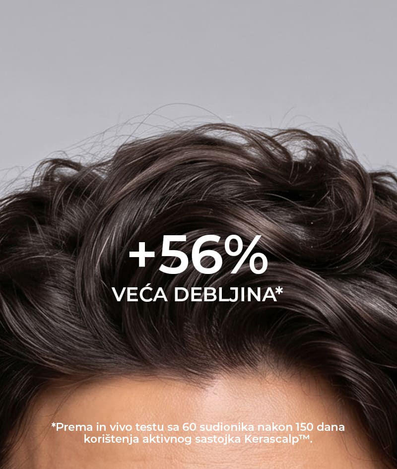 GROW Men’s Hair Loss Guard Shampoo: Šampon protiv ispadanja kose za muškarce s KERASCALP™ i biostimulatorima. Djeluje na hormon DHT. Aktivira rast i usporava biološko starenje vlasišta.